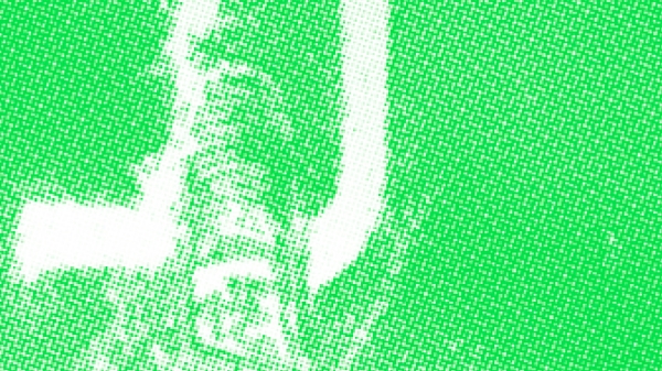 ©
Mueller-Divjak Grünes AIL Poster mit verpixeltem Foto